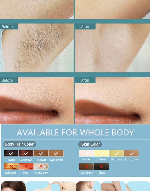 Ovelix SilkGlow™ IPL Hair Remover