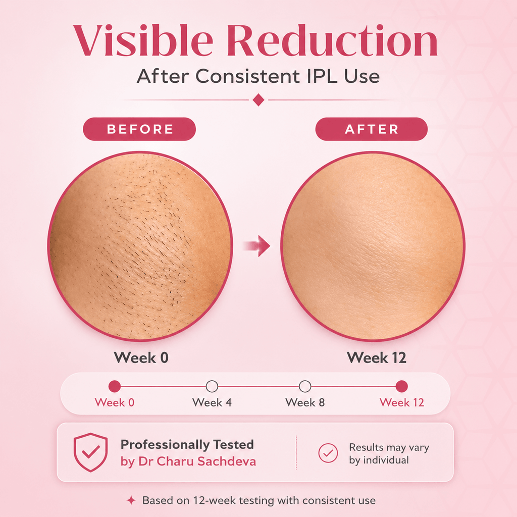 Ovelix SilkGlow™ IPL Hair Remover